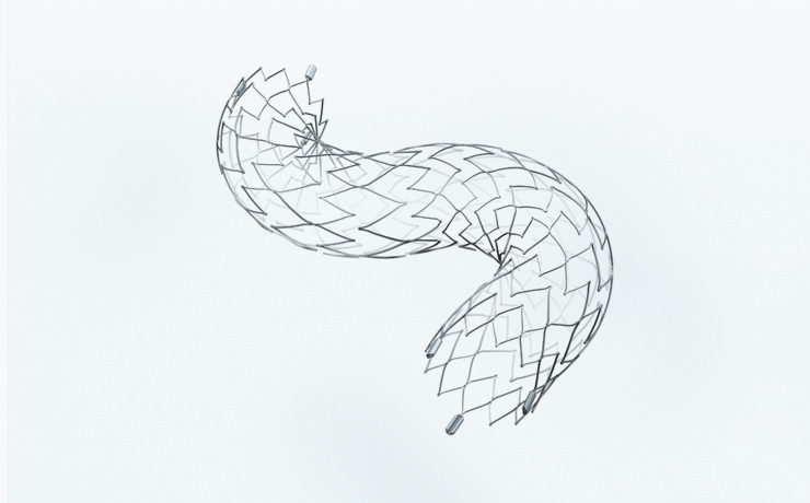 Neurovascular Stents