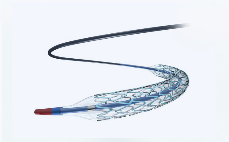 braided catheter