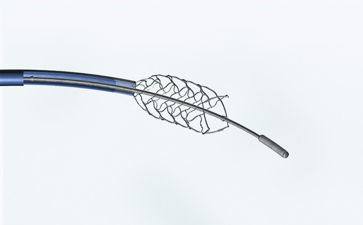 Neurovascular Stents