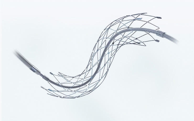 Neurovascular Stents