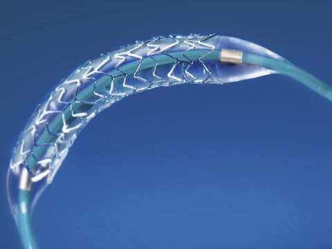 Thrombectomy Stents